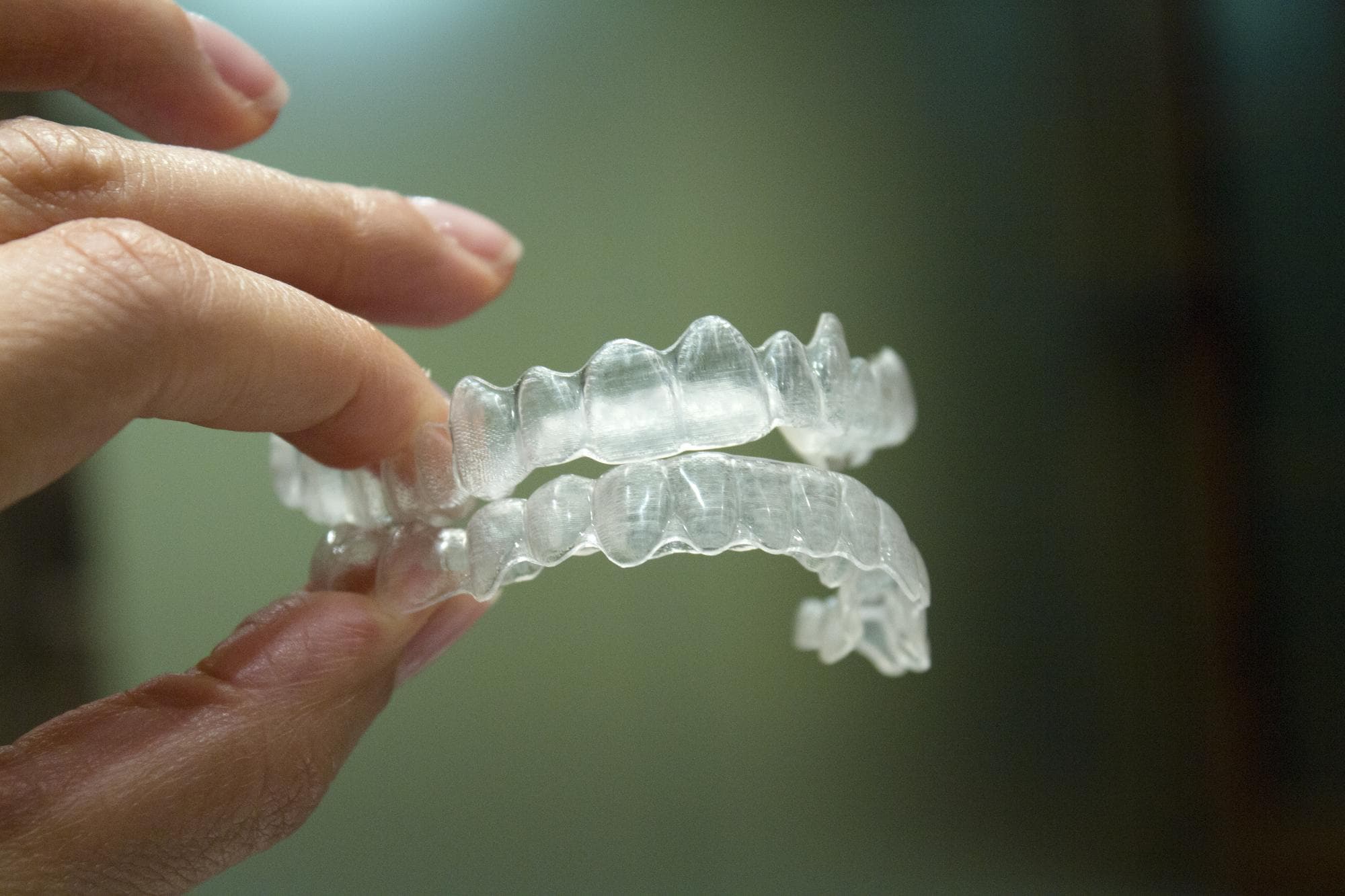 Custom Night Guards treatment at Smiles4Life Dental & Braces, Thousand Oaks