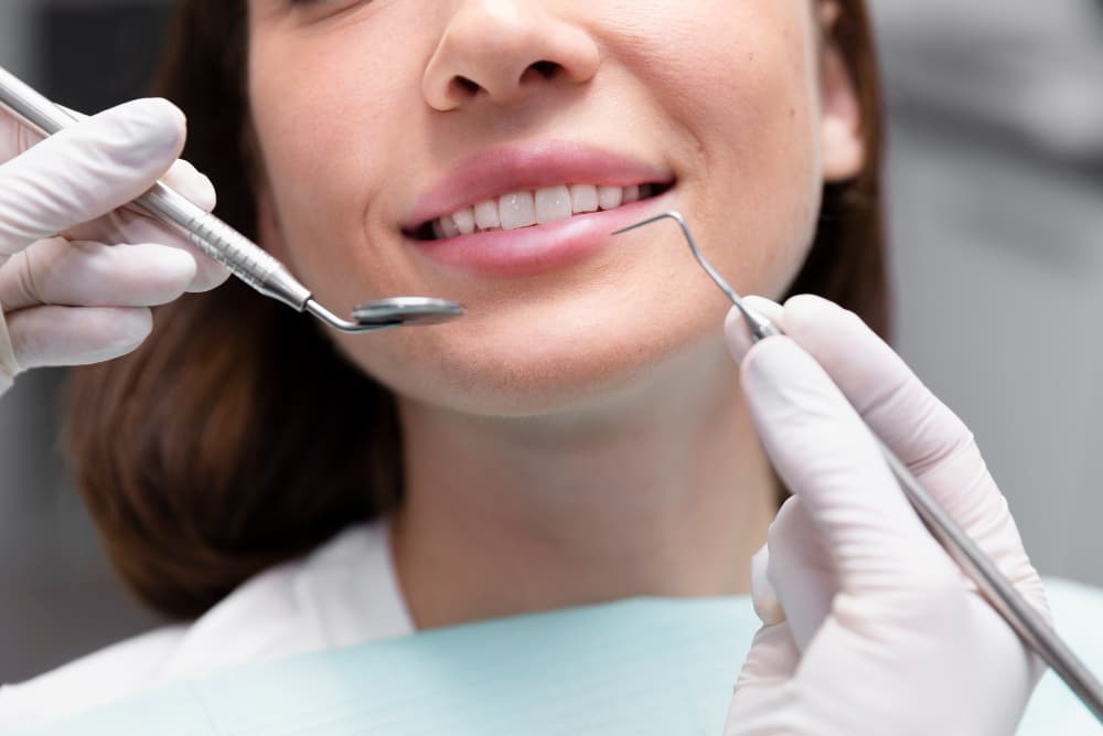 Gingivectomy treatment at Smiles4Life Dental & Braces, Thousand Oaks