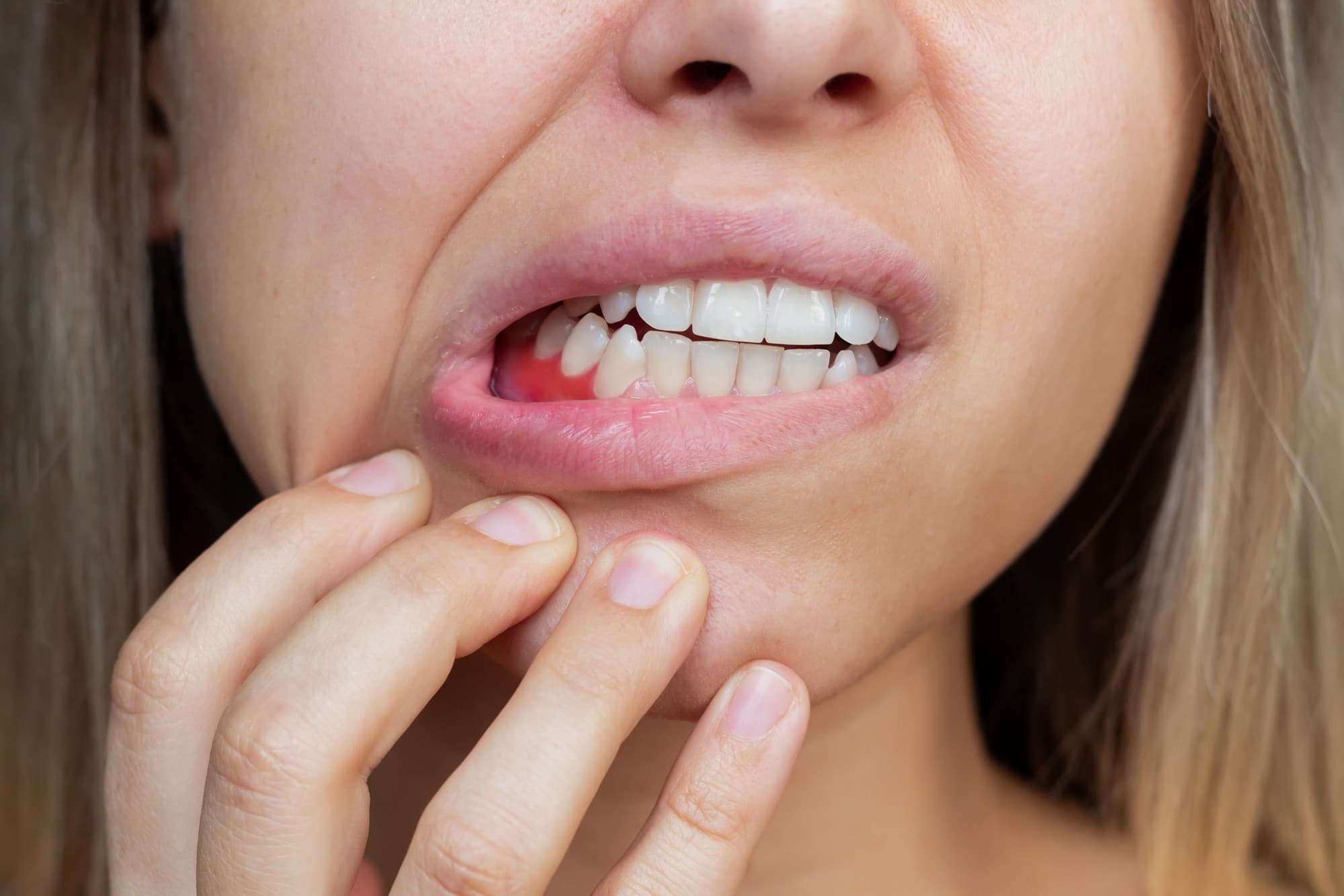 Gum Recession Treatment treatment at Smiles4Life Dental & Braces, Thousand Oaks