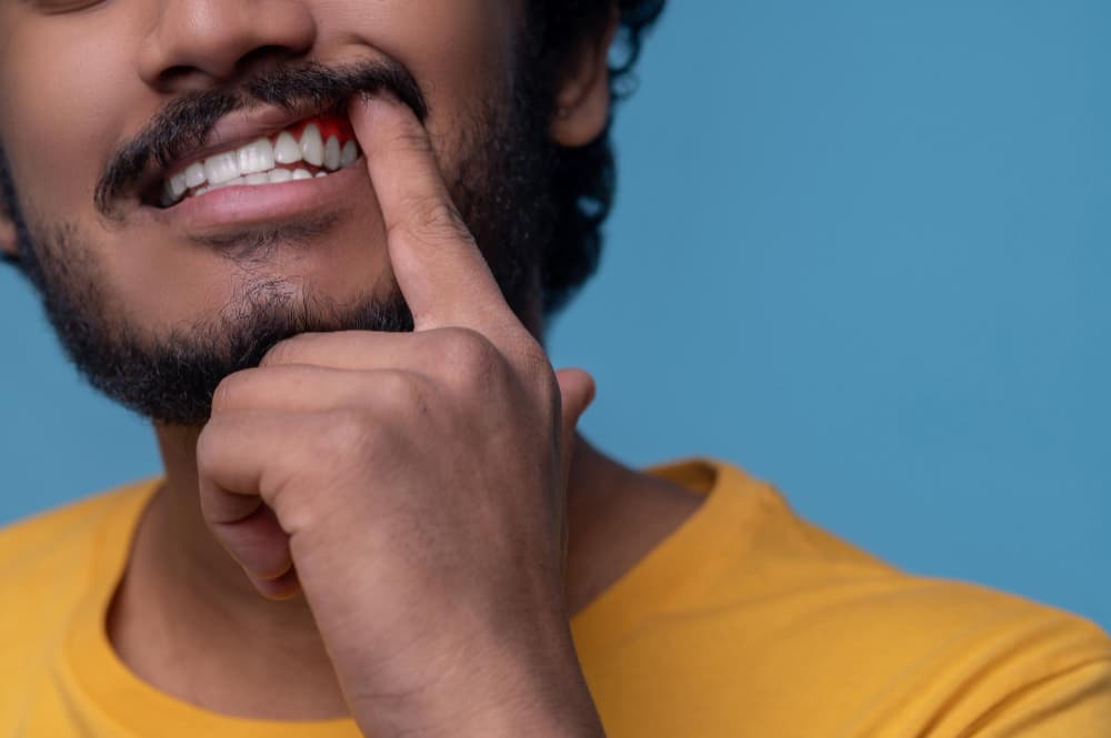 Gum Surgery treatment at Smiles4Life Dental & Braces, Thousand Oaks