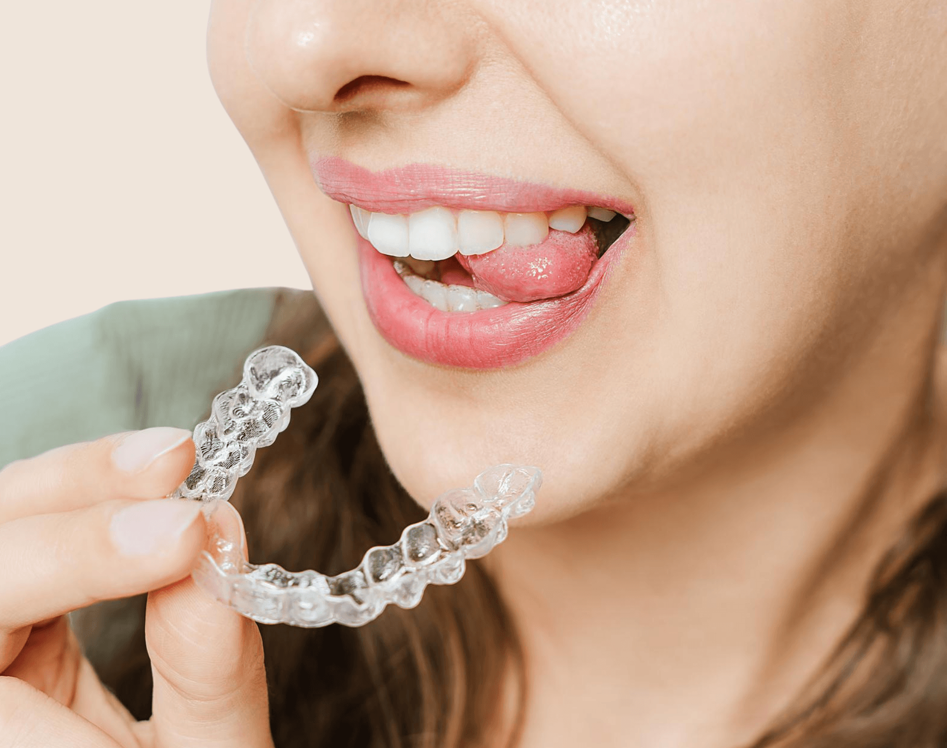 Invisalign & Clear Aligners treatment at Smiles4Life Dental & Braces, Thousand Oaks
